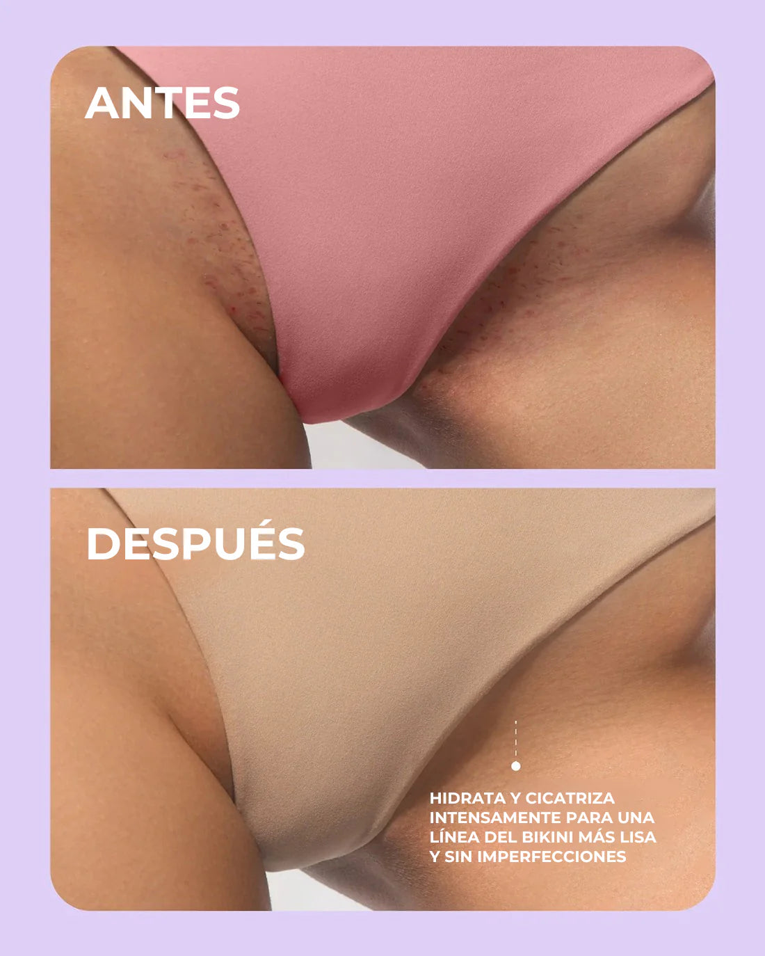 Kit Máxima Hidratación y Depilación Perfecta Truly